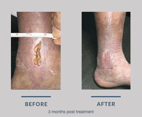 Before-After Before-After