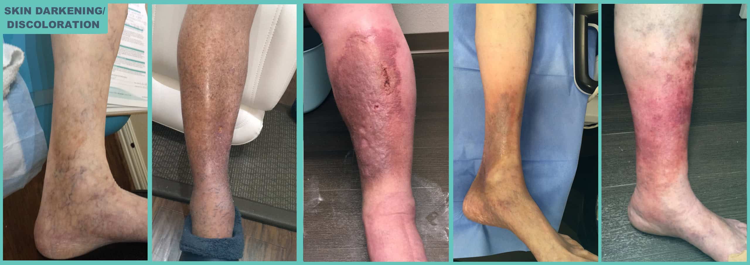 Skin-Darkening Skin-Darkening