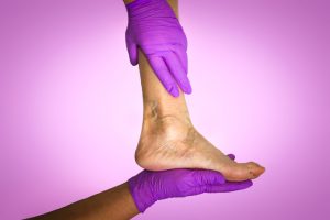 Vein Treatment Options Arlington TX