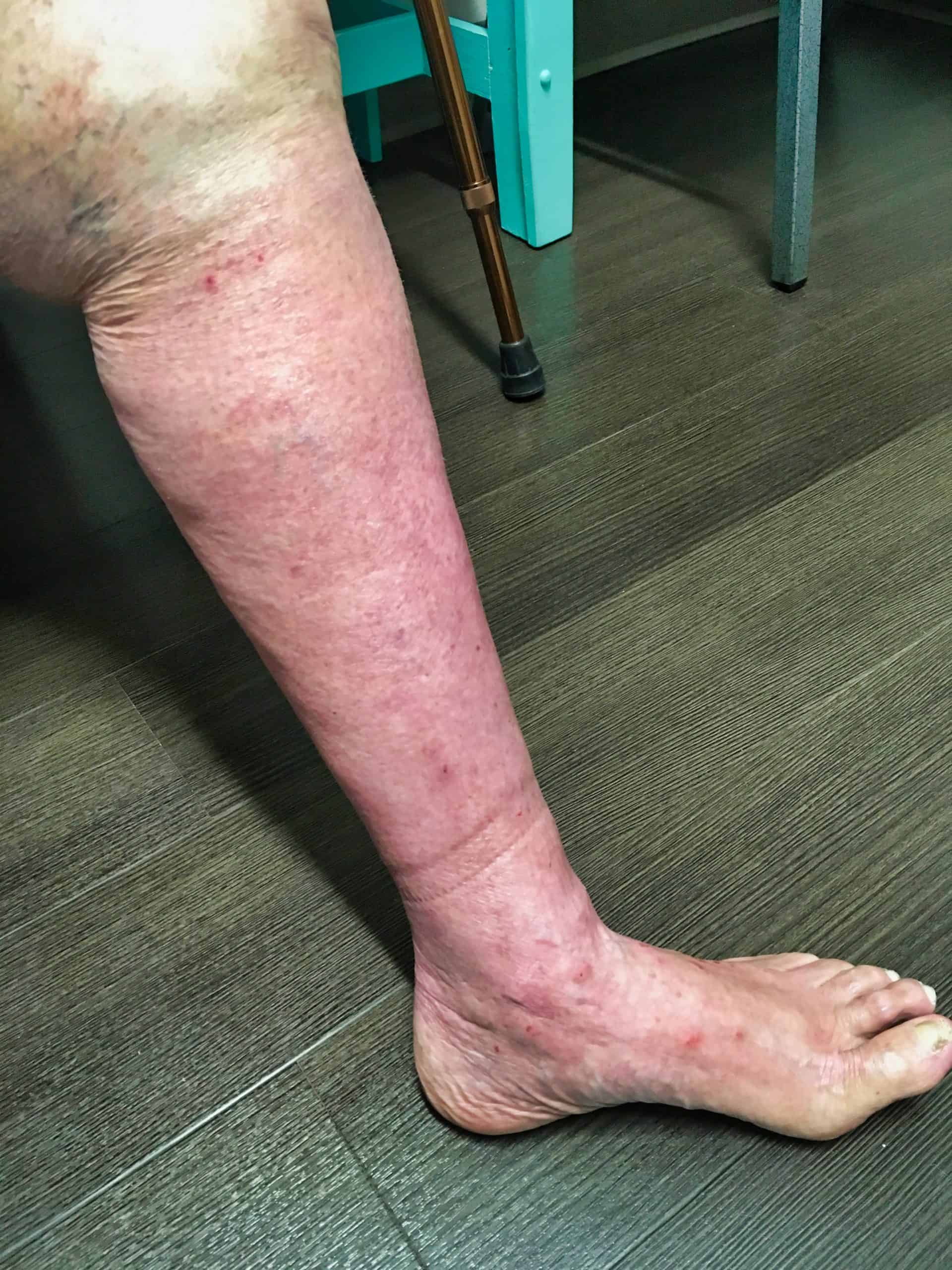 Discoloration after 4 months Discoloration after 4 months