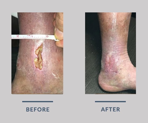before and after photos